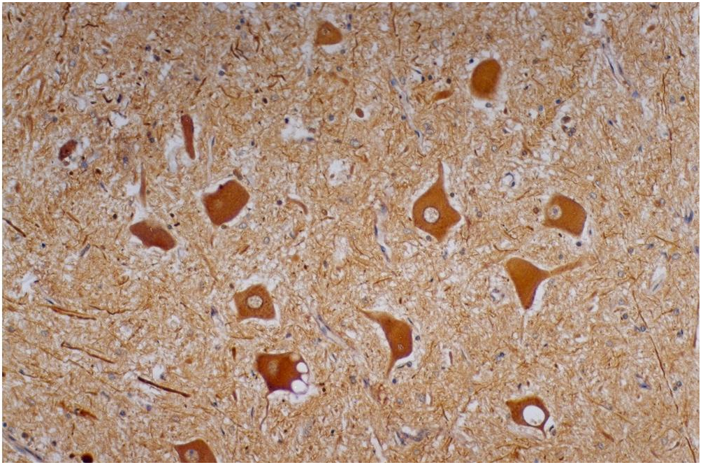 Neurofilament H Antibody