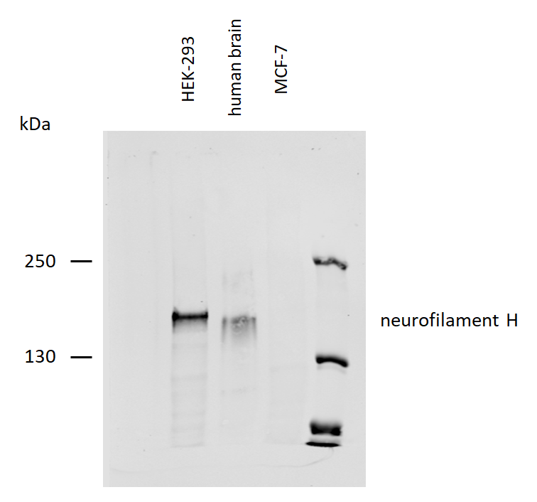 Neurofilament H Antibody