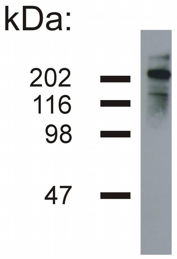 Neurofilament H Antibody