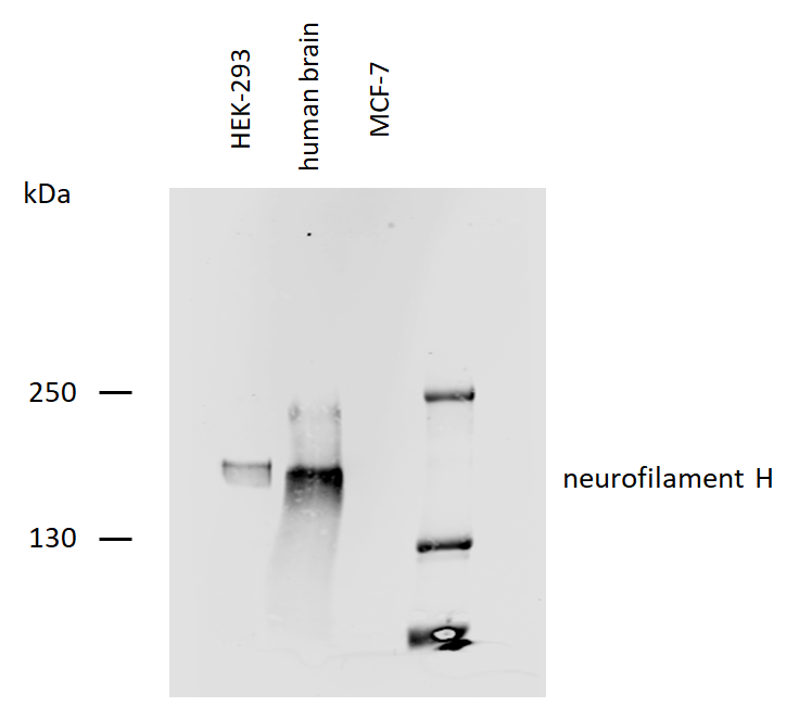 Neurofilament H Antibody