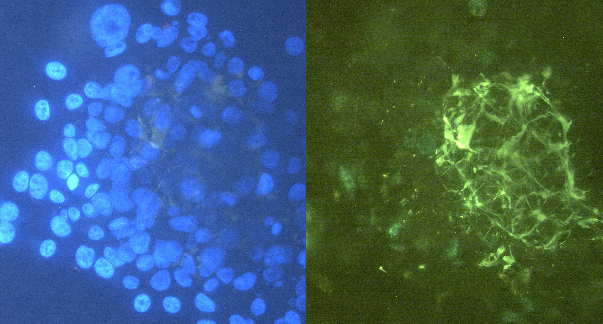Tenascin C Antibody