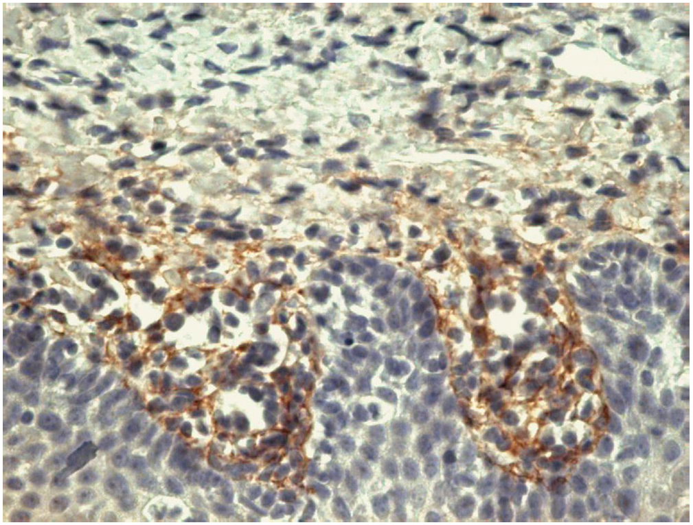 Tenascin C Antibody