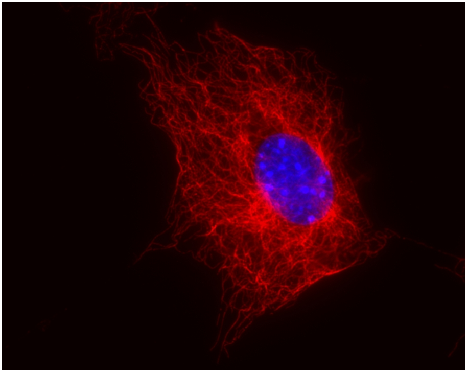 beta-Tubulin Antibody