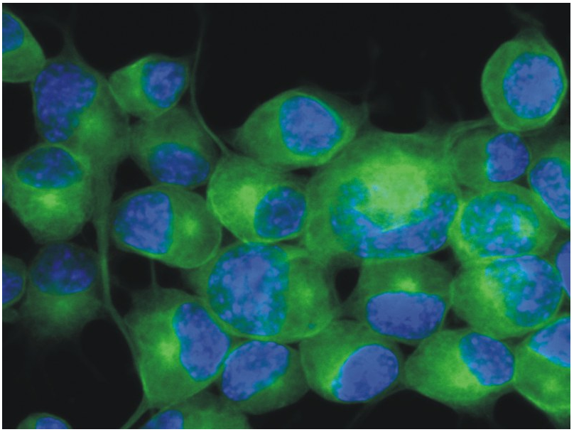 betaIII-Tubulin Antibody