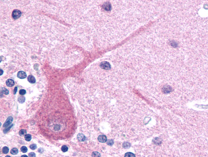 betaIII-Tubulin Antibody