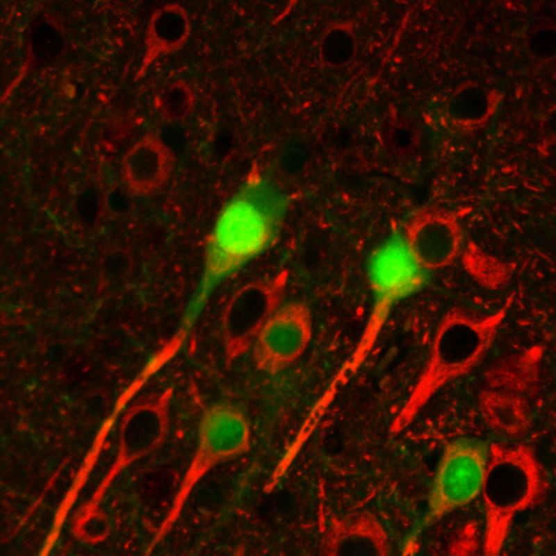 betaIII-Tubulin Antibody