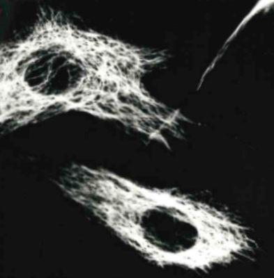Vimentin Antibody