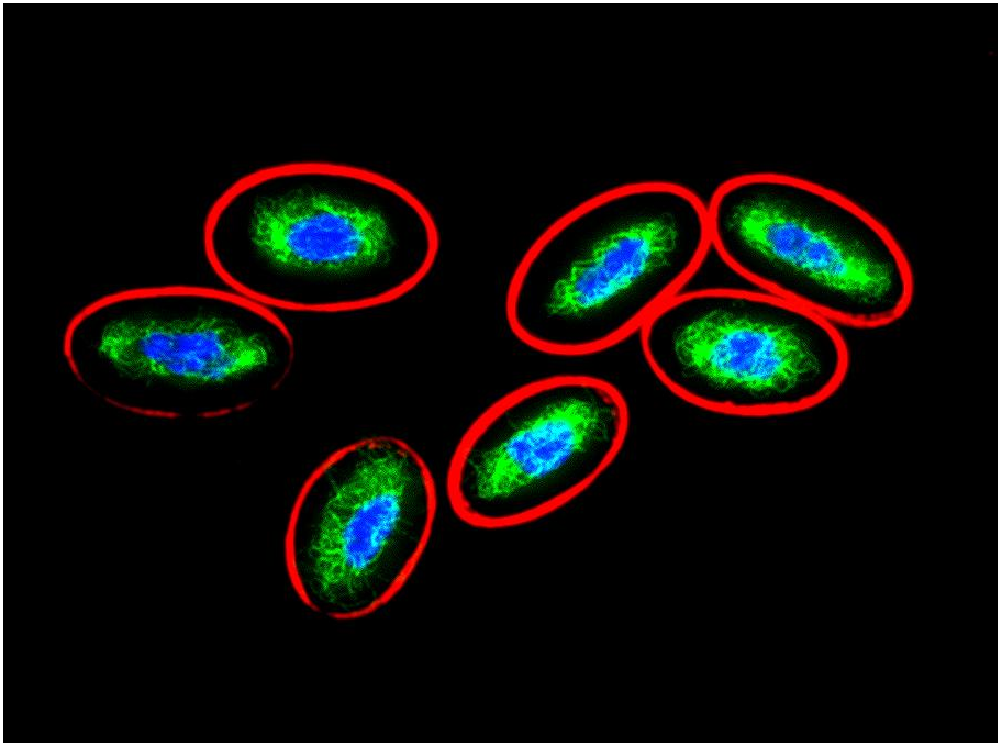 Vimentin Antibody