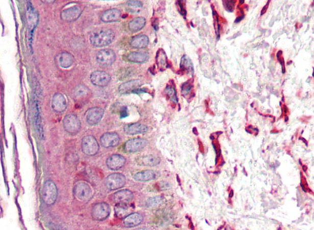 Vimentin Antibody