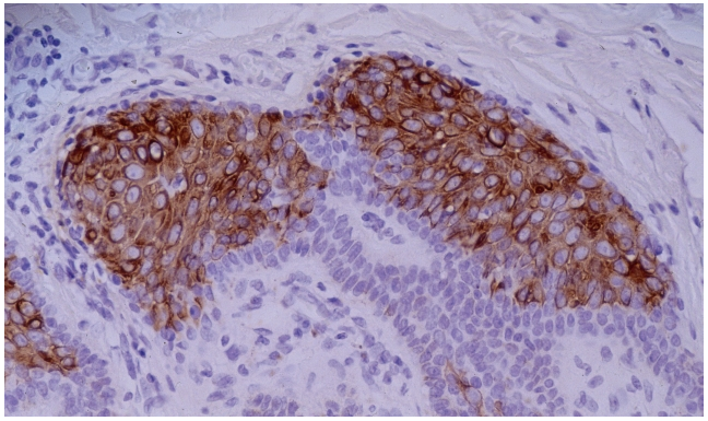 Cytokeratin 10 Antibody