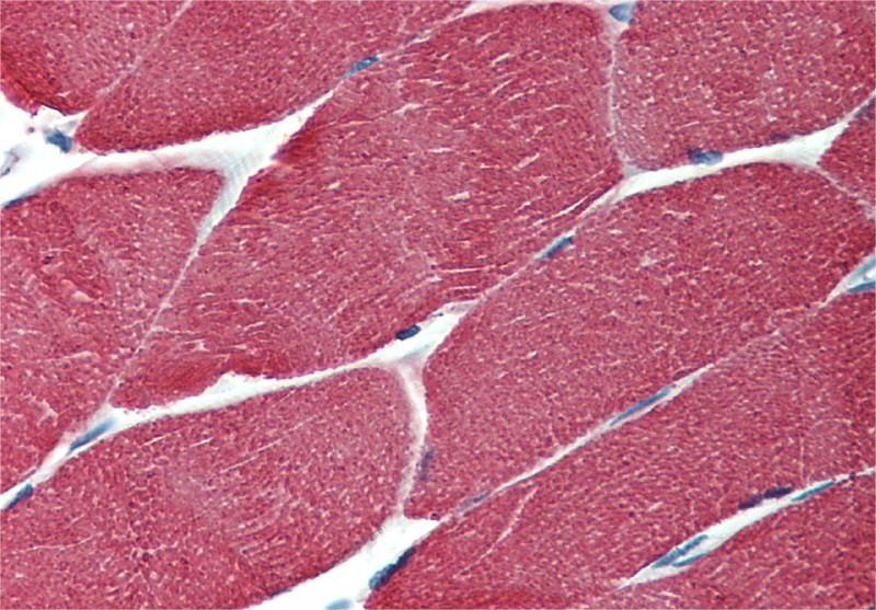 Actin (muscle) Antibody