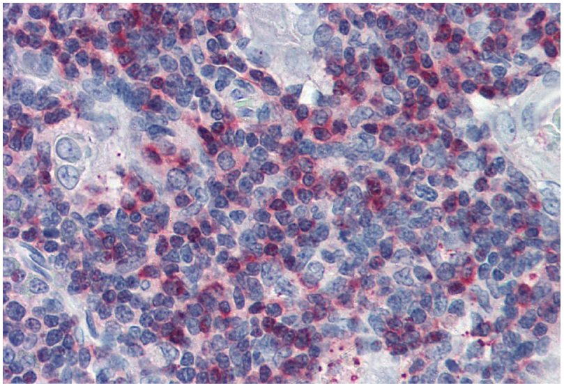 SLP76 Antibody