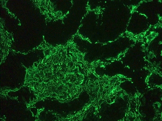 Recombinant mouse vimentin Antibody