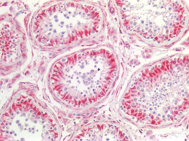 Recombinant mouse vimentin Antibody