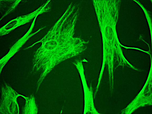 Recombinant rabbit vimentin Antibody