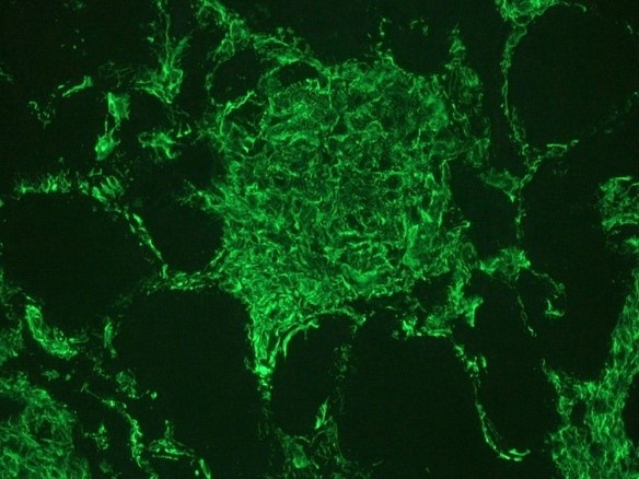 Recombinant rabbit vimentin Antibody