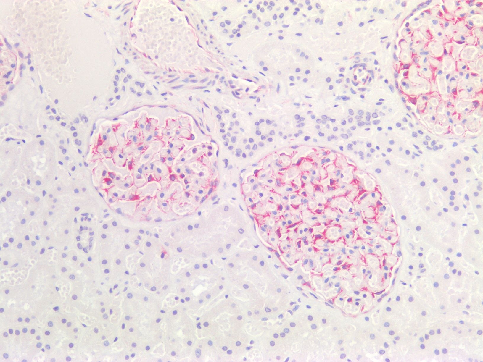 Recombinant rabbit vimentin Antibody