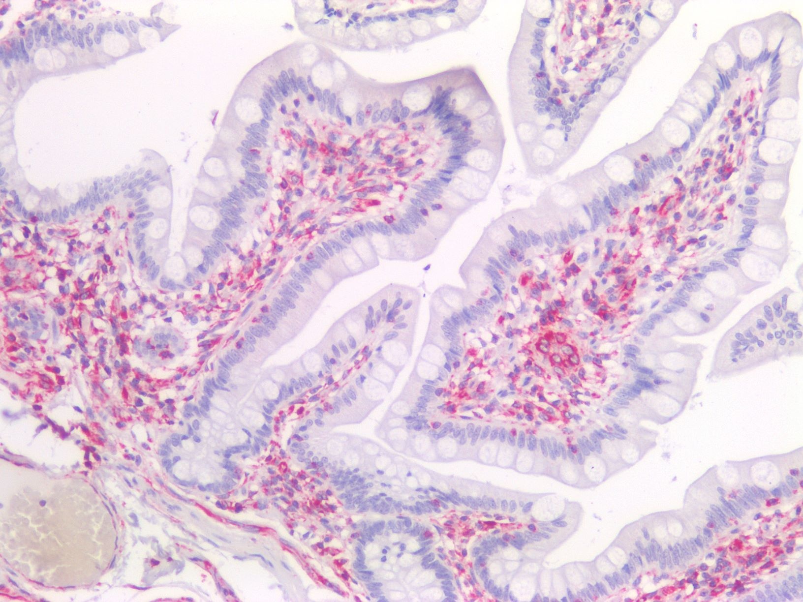 Recombinant rabbit vimentin Antibody