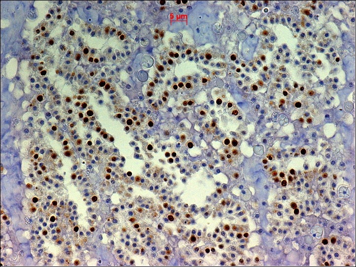 Mouse Bromodeoxyuridine / BrdU Antibody