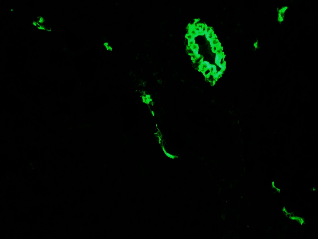 Mouse Cytokeratin 7 / Keratin K7 Antibody