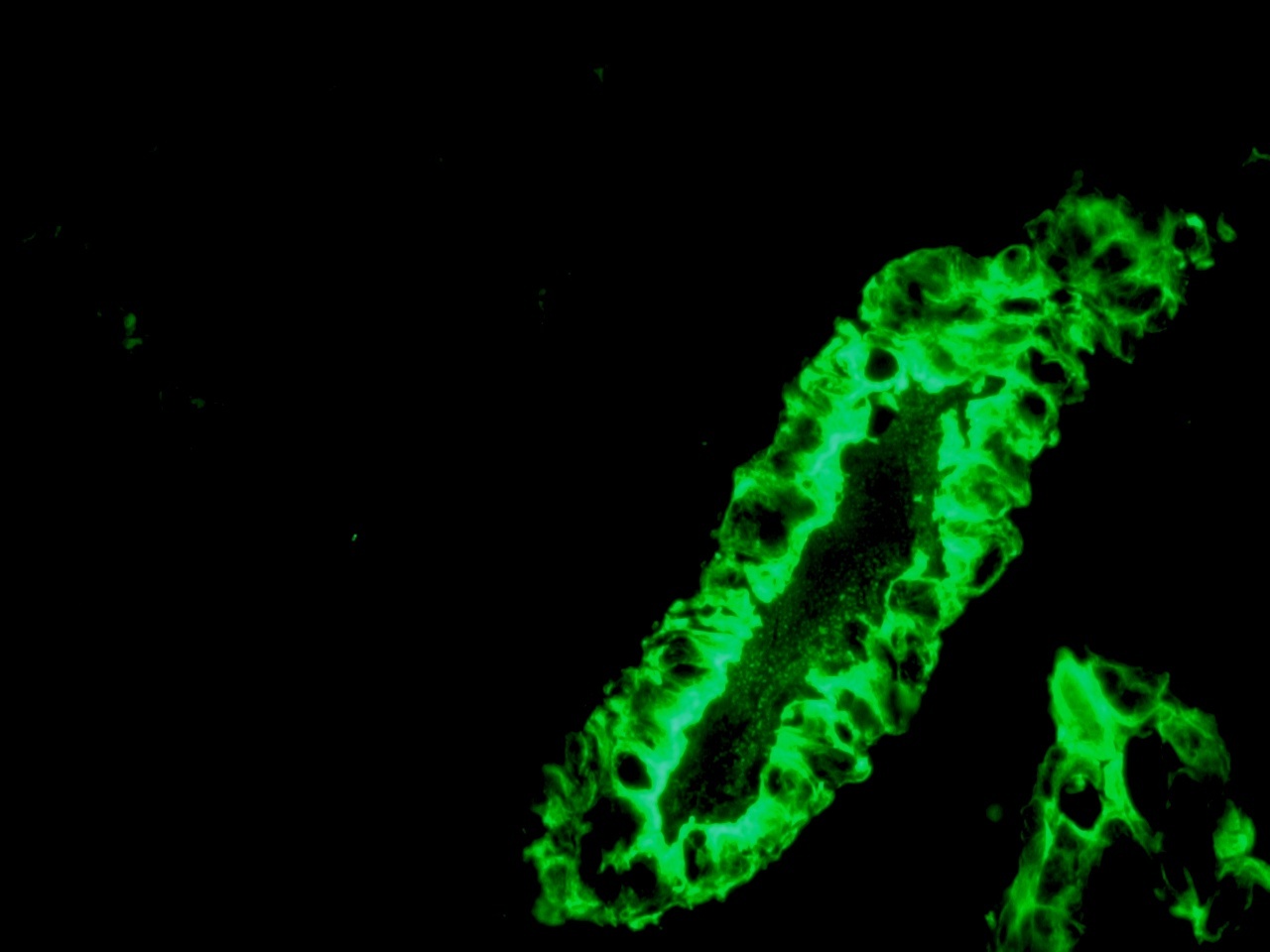 Mouse Cytokeratin 7 / Keratin K7 Antibody
