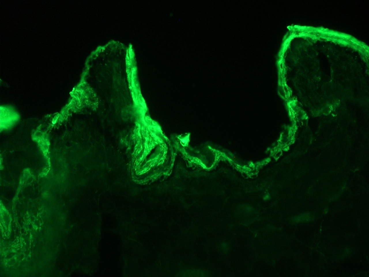 Mouse Cytokeratin 10 / Keratin K10 Antibody