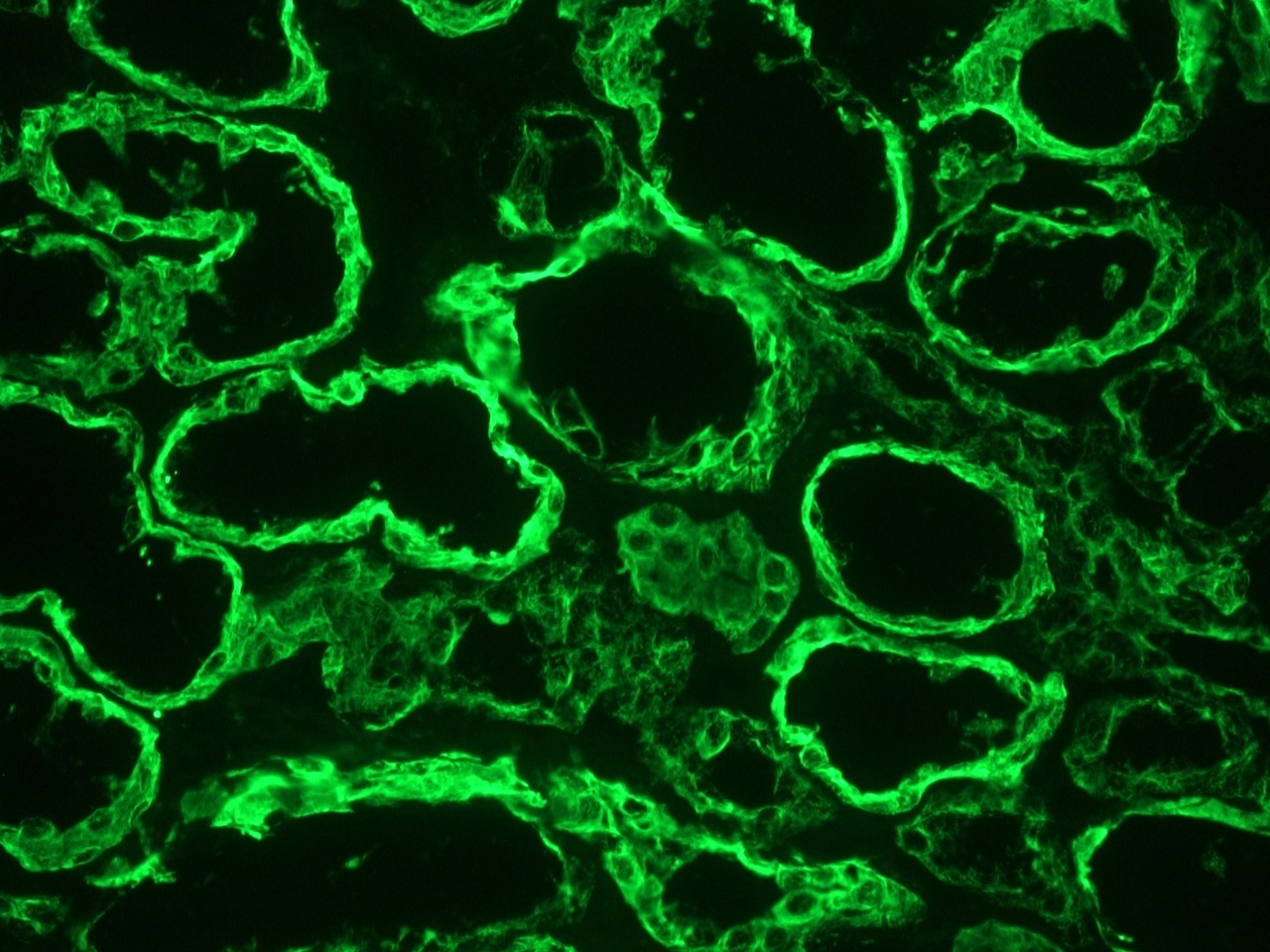 Mouse Cytokeratin 18 / Keratin K18 Antibody