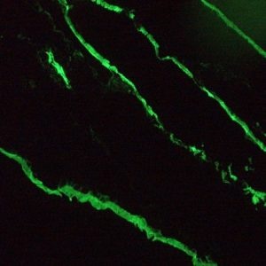 Mouse Cytokeratin 18 / Keratin K18 Antibody