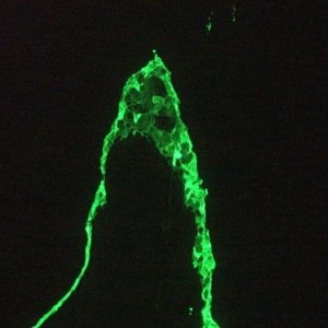 Mouse Cytokeratin 18 / Keratin K18 Antibody