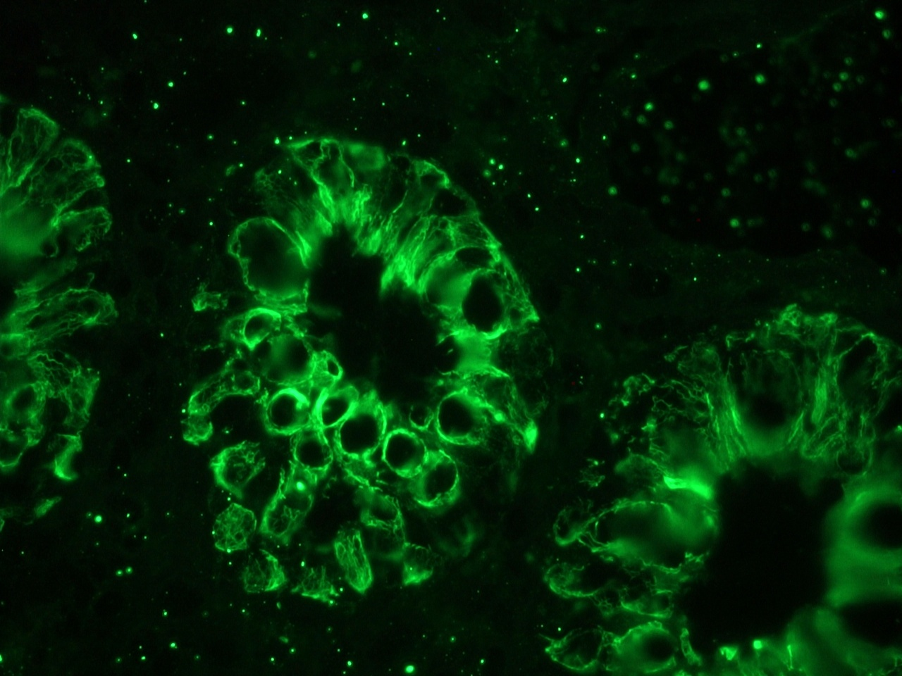 Mouse Cytokeratin 18 / Keratin K18 Antibody