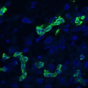 Mouse Cytokeratin 19 / Keratin K19 Antibody