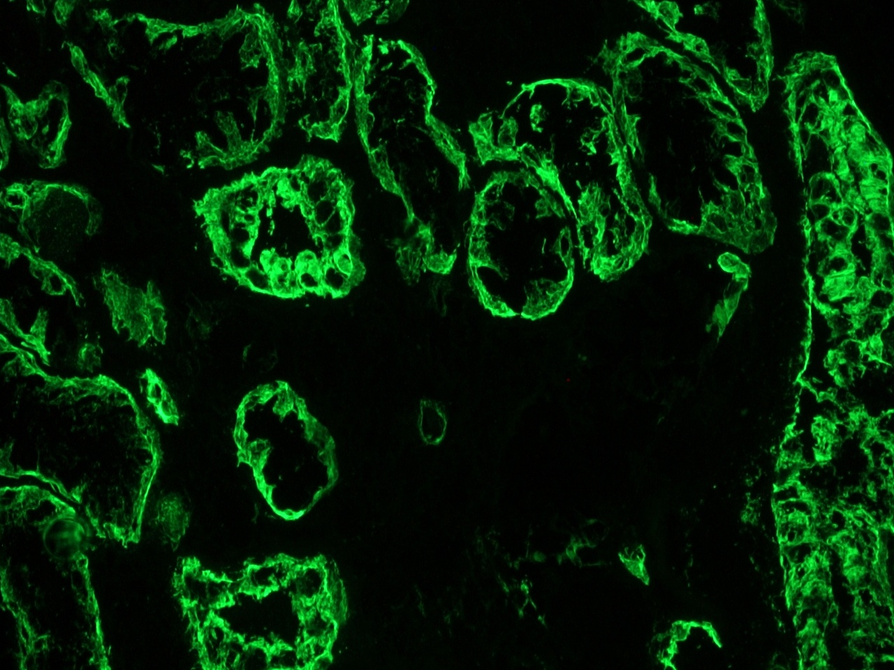 Mouse Cytokeratin 19 / Keratin K19 Antibody