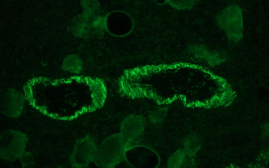 Mouse Smoothelin Antibody
