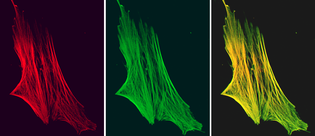 Mouse Smoothelin Antibody