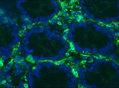 Mouse Vimentin Antibody