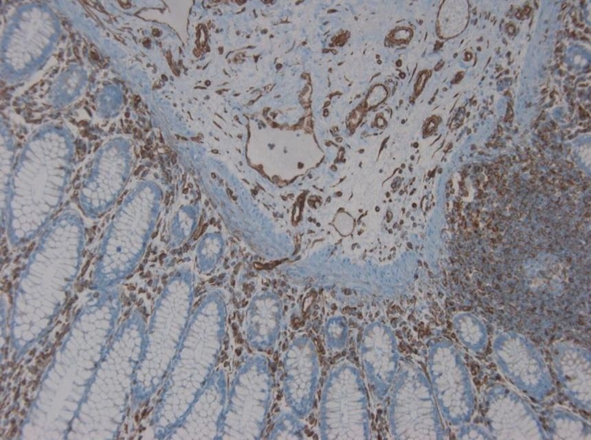 Mouse Vimentin Antibody