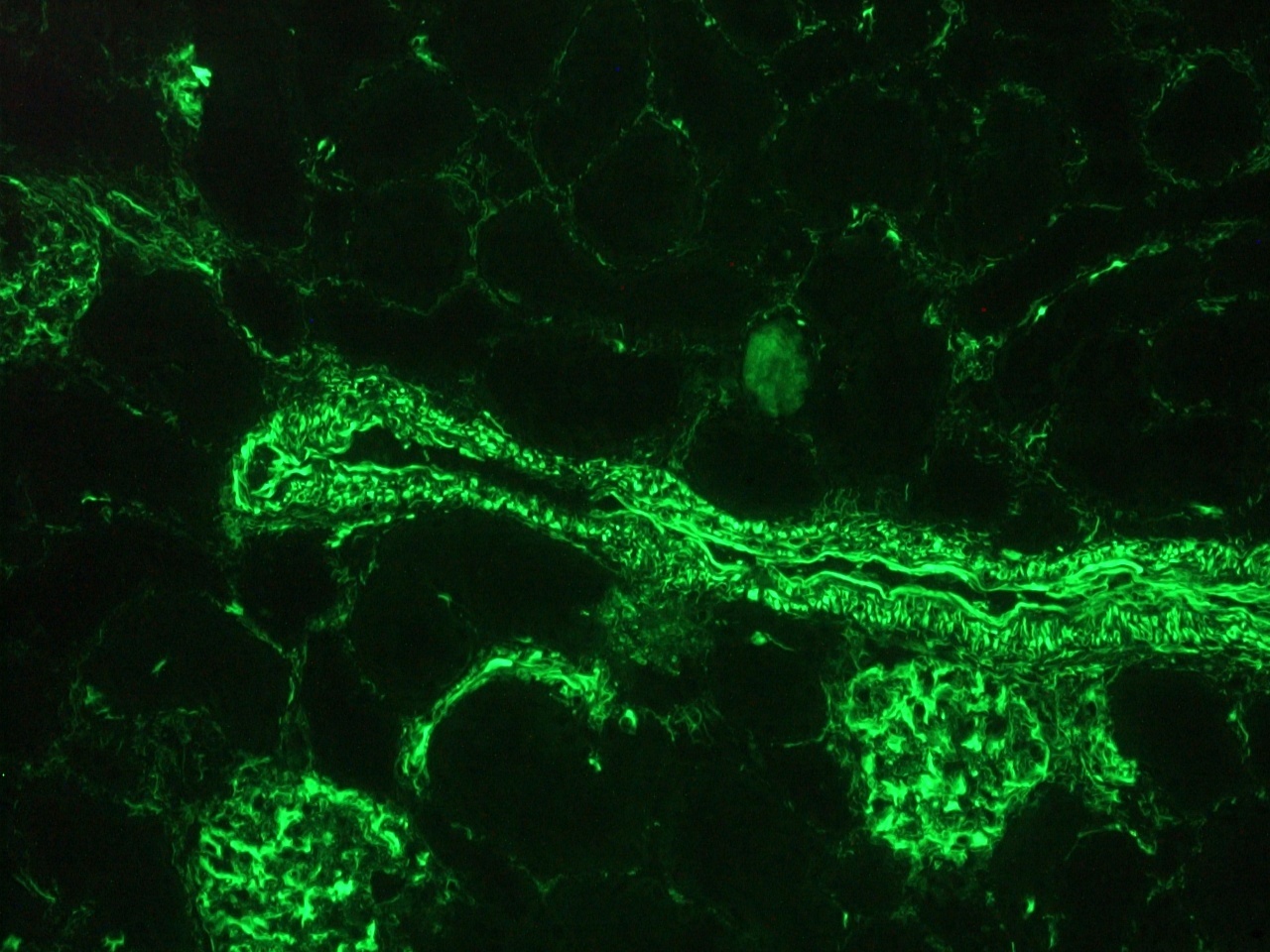 Mouse Vimentin Antibody