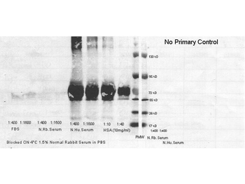 ALB Antibody