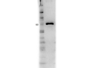 ALB Antibody