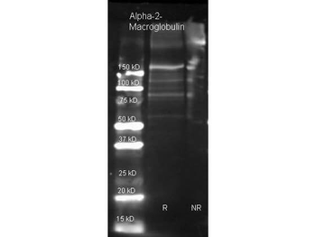 A2M Antibody