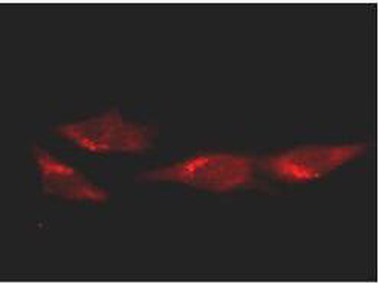 TP53 Antibody