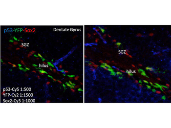 TP53 Antibody