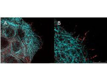 AKT1 Antibody