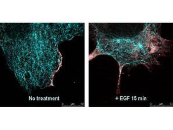 AKT1 Antibody