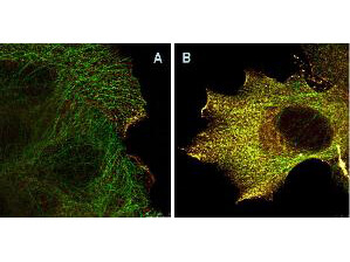 AKT1 Antibody