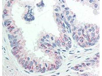 AKT1 Antibody