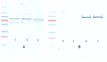 AKT1 Antibody