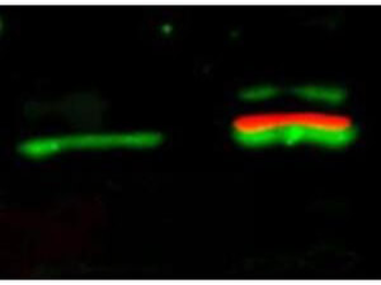 AKT1 Antibody