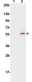 AKT1 Antibody