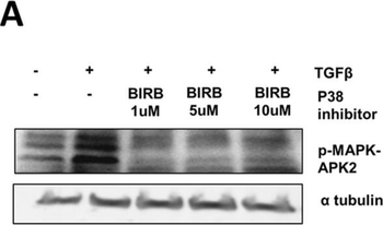 TUBA1B Antibody